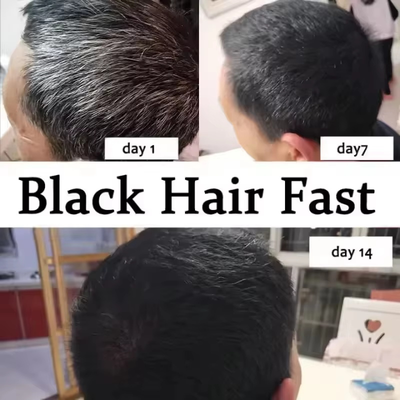 Сыворотка для лечения седых во – обзор и цена Hair Care Ginseng