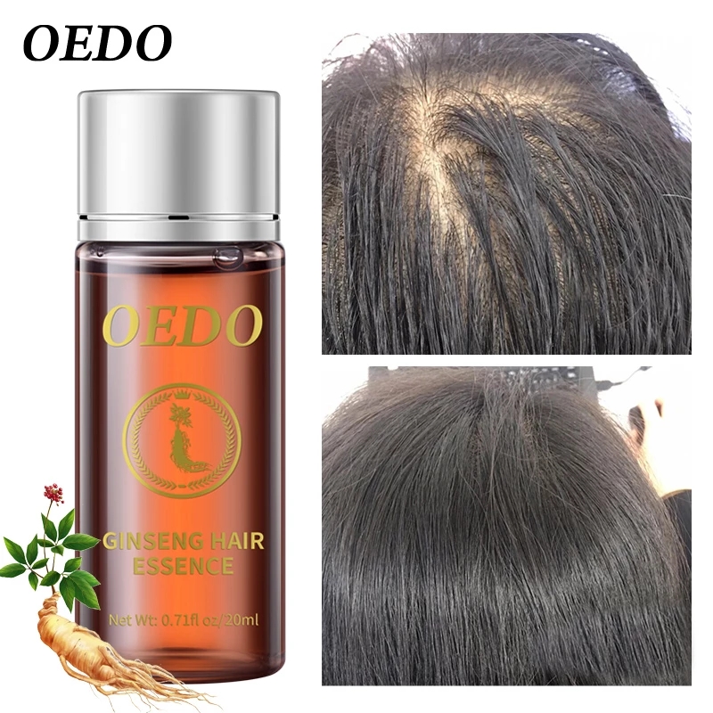 20 мл эссенция для роста волос – обзор и цена Hair Care Ginseng